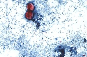 Read more about the article More than 18,200 cyclosporiasis cases now suspected in US: Where it’s getting worse