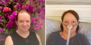 Read more about the article I thought I was exhausted by being a single, middle-aged parent. I learned sleep apnea was the culprit.