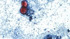 Read more about the article 40 percent report buying less produce amid cyclospora outbreak: Poll