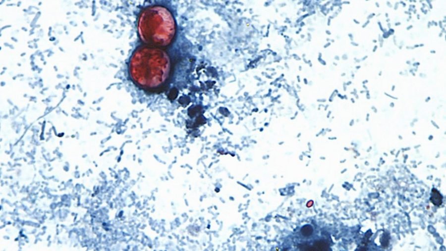You are currently viewing 40 percent report buying less produce amid cyclospora outbreak: Poll
