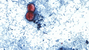 Read more about the article Cyclospora cases mounting in Michigan