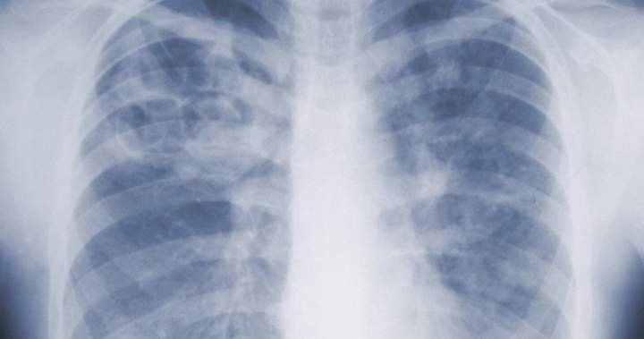 You are currently viewing Are you underestimating mold-related illness? What U.S. study says