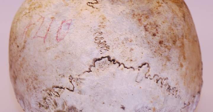 You are currently viewing Skull found in 1975 belongs to Uxbridge, Ont. WWI veteran: police