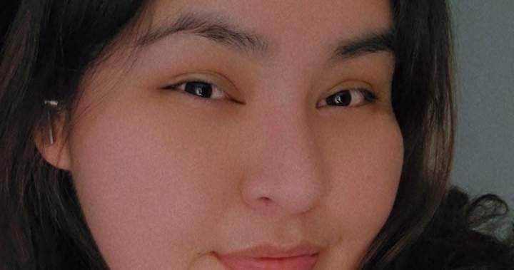 Read more about the article Family of woman who died in e-scooter accident pleads for riders to wear helmets