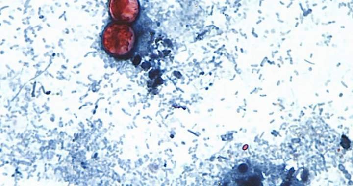 You are currently viewing Michigan reports first U.S. deaths from multi-state cyclosporiasis outbreak
