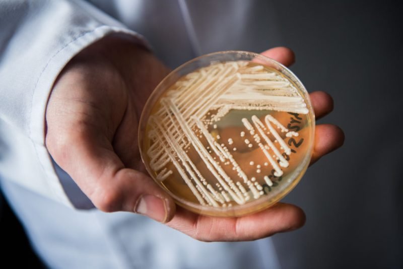 Read more about the article Superbug confirmed in 23 states: Where is the deadly fungus spreading in 2026?